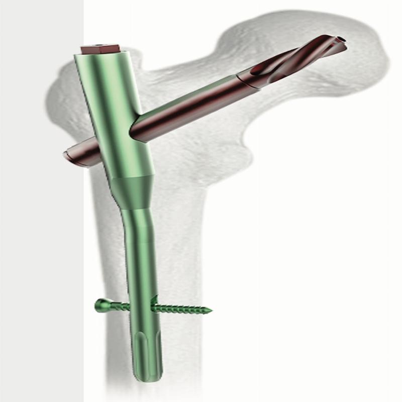 Auxein - 130° AJAX(PFNA) стрижень для проксимального відділу стегна, короткий